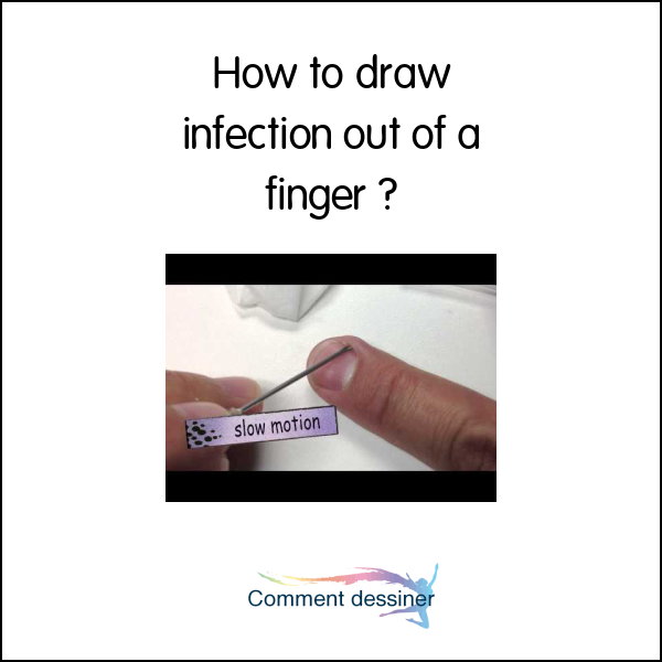 How to draw infection out of a finger How to draw